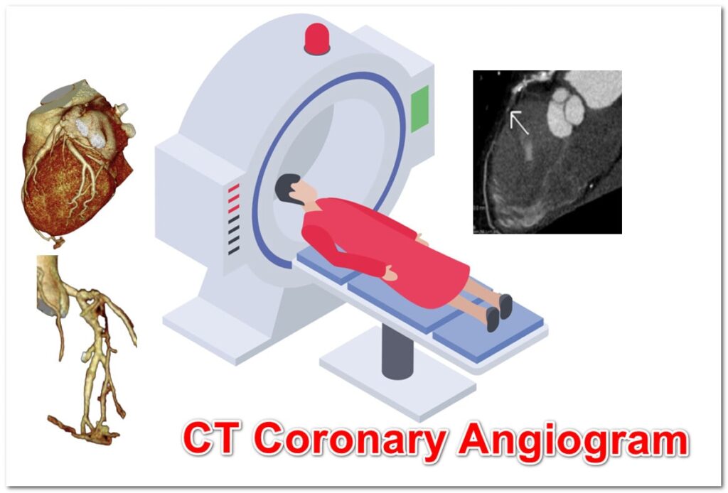CT coronary angiogram test for the heart in Hyderabad
