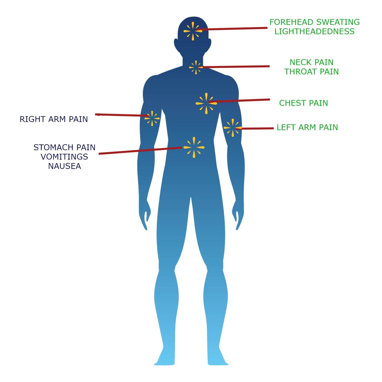 The Complete Guide to Myocardial Infarctions (aka Heart Attacks)