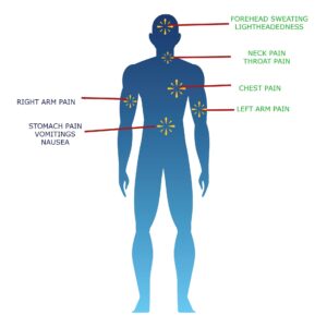 MAN WITH SYMPTOMS OF A HEART ATTCKLIKE CHEST PAI, NECK PAIN, LEFT ARM PAIN, SWEATING, GIDDINESS, STOMACH PAIN