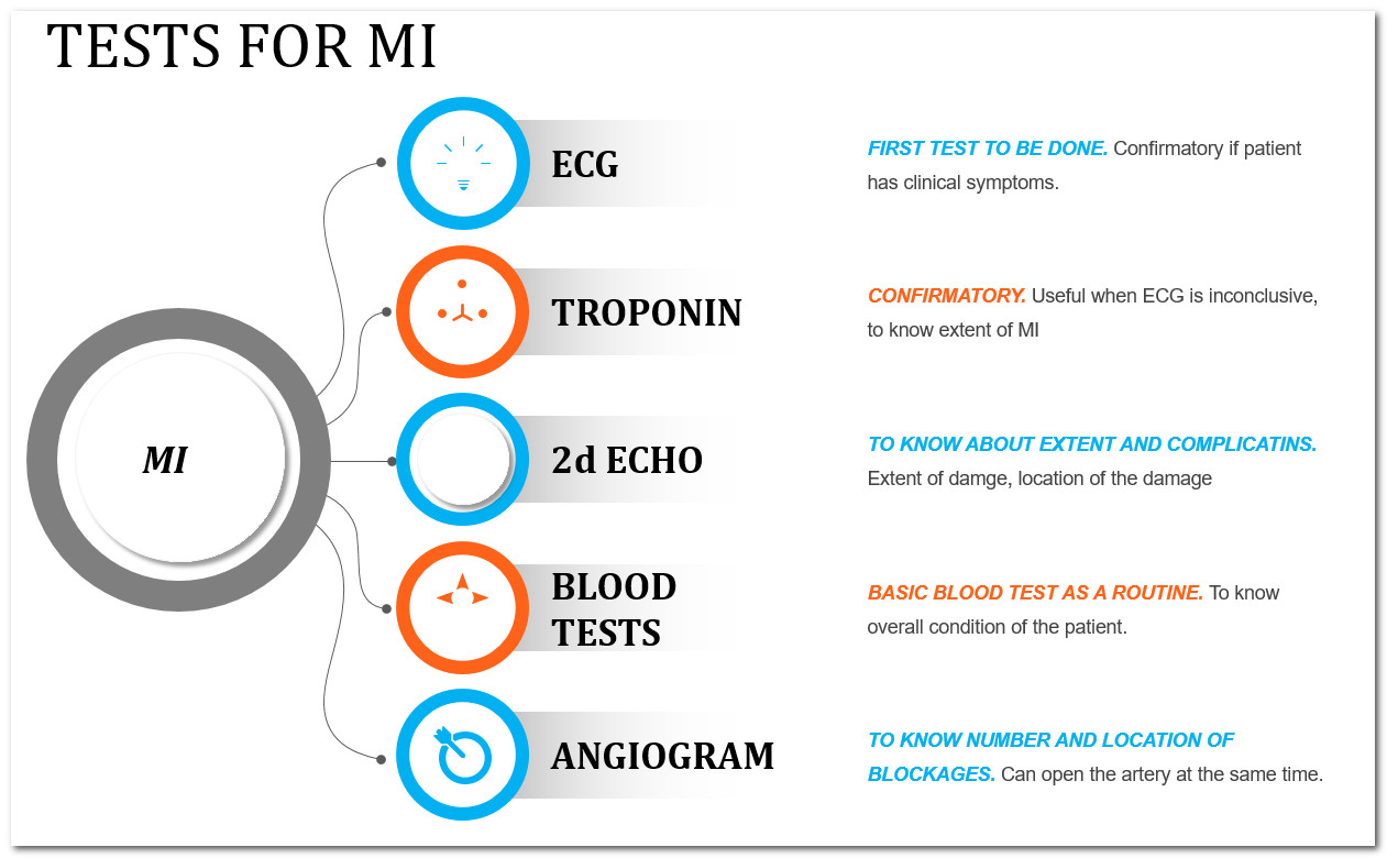 INFOGRAPHICS - CARDIAC TESTS NEEDED DURING MYOCARDIAL INFARCTION