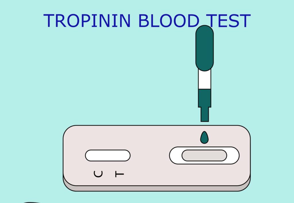 Performing Troponin test to confirm heart attack on troponin Kit