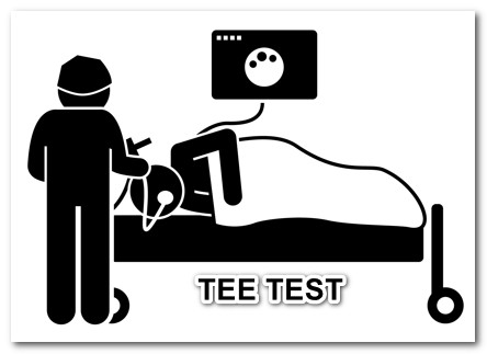 What is TEE test for the heart