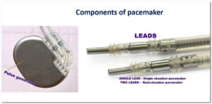 Dual-chamber Pacemaker with Pulse generator and leads