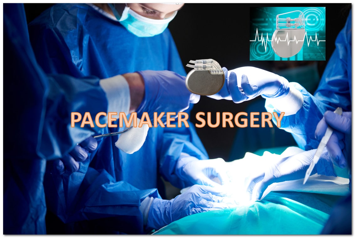 PACEMAKER SURGERY IN A HYDERABAD HOSPITAL