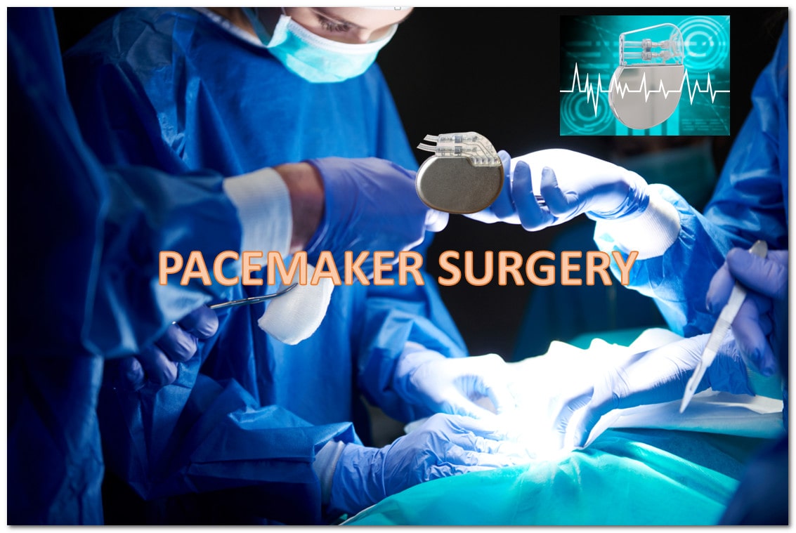 pacemaker-surgery-cost-in-hyderabad-india-dr-malleswara-rao