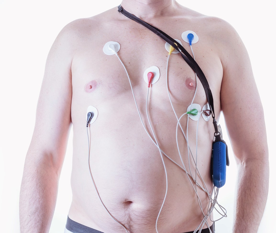 A heart patient undergoing a Holter test